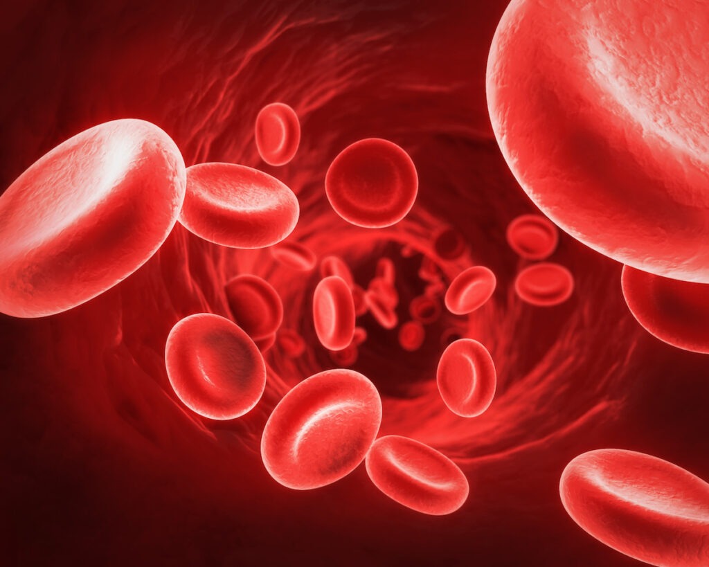 hemoglobina scazuta